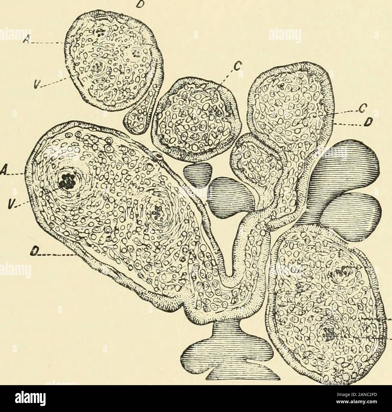 A textbook of obstetrics . iten u. Abnorm. der Placenta, Gem. Deutsche Zeitschr.f. Geburtsh., Bd. v, 518. 4Edin. Monthly Jour, of Med. Sci., Feb., 1845; Obstet. Works, vol. ii, P- 445- 5 See Frankel, Ueber Placentar Syphilis, Archiv f. Gyn., Bd. v, S. 6. THE PLACENTA. 125 ever, reference to its connection with syphilis,—was the mostfrequent form of placental syphilis. According to Frankel, this infiltration of the villi with granu-lation-cells, and their consequent increase in size and distortedshapes, are characteristic of syphilis and make certain the diag-nosis of the disease. As to the sea Stock Photo