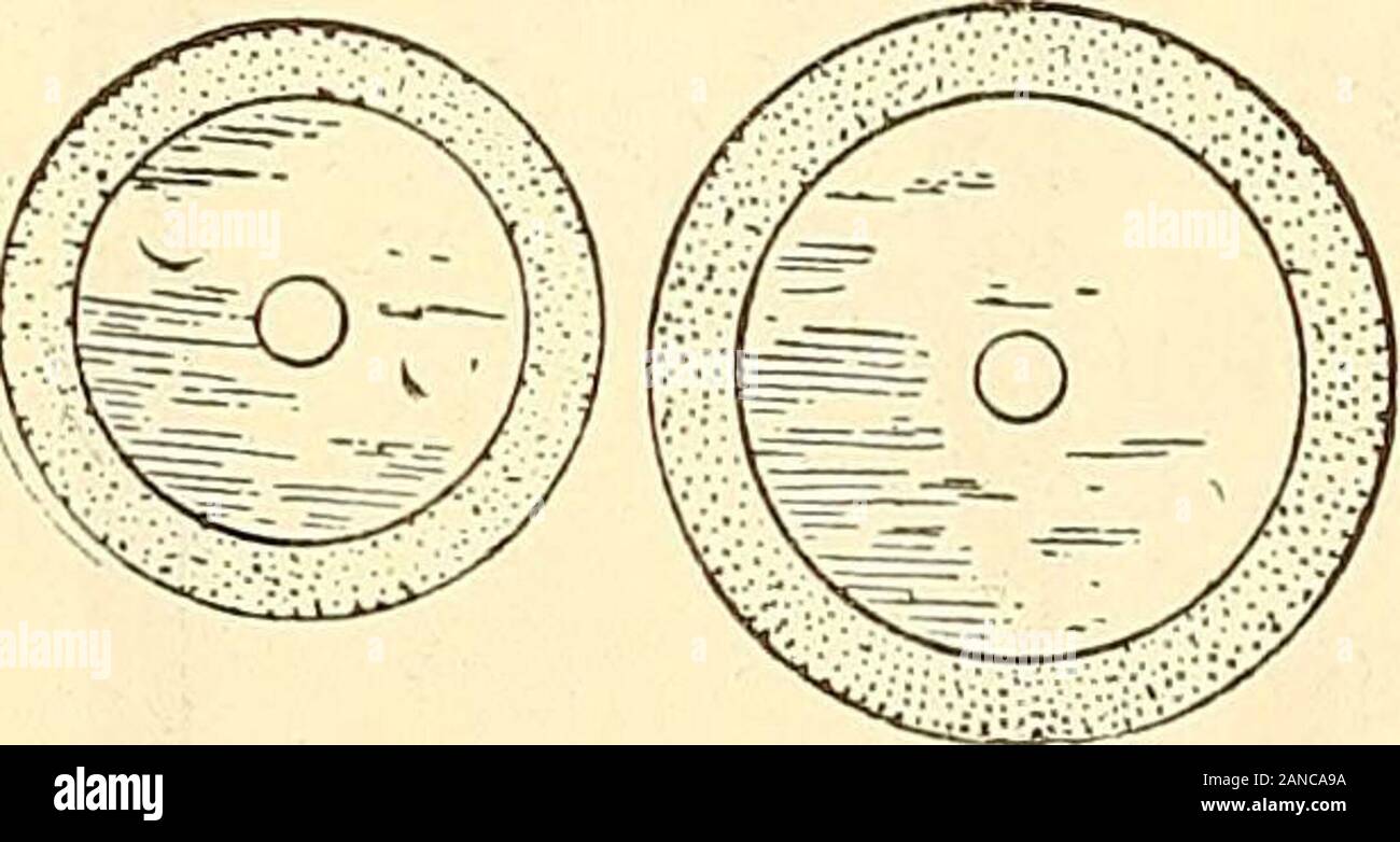 Dentalengine hires stock photography and images Alamy