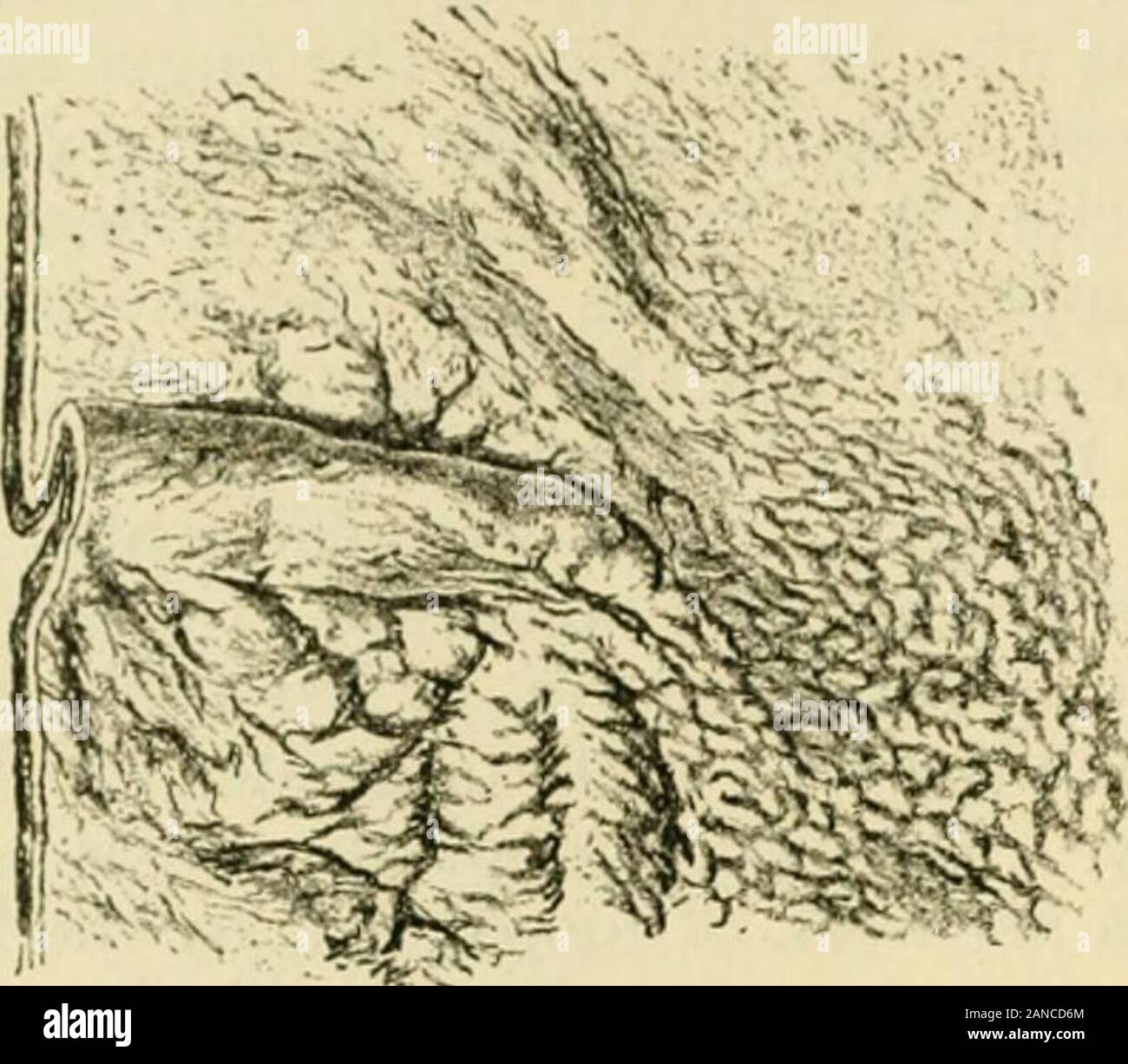 Human anatomy, including structure and development and practical considerations . embling adenoid tissue,covered by a single layer of columnar epithelium exhibiting a cuticular border. Thechief difference, on the other hand, is the absence of villi, in consequence of whichthe velvety appearance imparted by the latter is not seen in the large intestine.Valvulae conniventes are also wanting, although there are projections into the largegut involving all or a part of the coats internal to the serous tunic. The muscularismucosae is less regular in its development, being feebly represented in the c Stock Photo