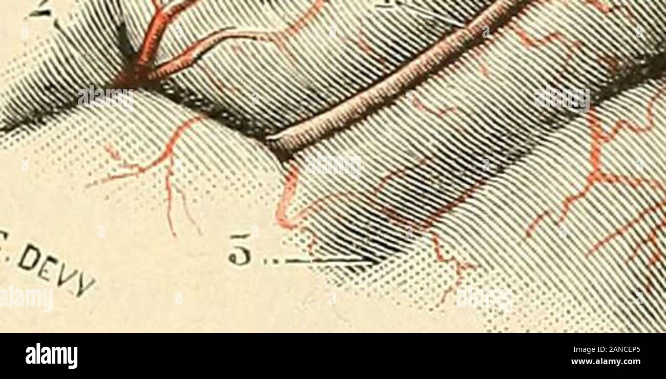 Traité d'anatomie humaine . I^. Fig. Gi7. Mode de rainescence dos arLùres corlicales dans la pie-mère(région du pli courbe). 1, arlcre du pli courbe, avec l cl I, ses deux branches de bifurcation. —2, exlrémilé poslérieure de la scissure de SUvius. — 3, scissure parallèle.— 4, pli courbe. — 5, lobule pariétal inlérieur. 11 résulterait, on le conçoit, dune pareille disposition, que chacun des grandsterritoires vasculaires, que nous avons décrits plus haut, se diviserait en terri-toires secondaires, ceux-ci en territoires tertiaires, etc., territoires qui seraientdautant plus indépendants quils Stock Photo