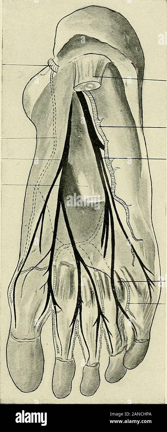 A text-book of clinical anatomy : for students and practitioners . Extensor hallucis brevis Anterior tibial ordeep peroneal nerveInternal saphenousvein ist metatarsal arterv External saphenous nerve (yellowExternal saphenous vein(black) Peroneus longus tendonPeroneus brevis tendon Outer malleolusExternal saphenousnerve Peronealtendon-sheath  Peronealsheath Abductor digiti V Extensor brevis digi-torum eroneus tertius Fig. 158.—Dissection of dorsum of foot: arteries, dotted; nerves shown in yellow—veins black (Frohse). 493 posterior tibial artery p Internal plantar artery-Internal plantar nerve Stock Photo