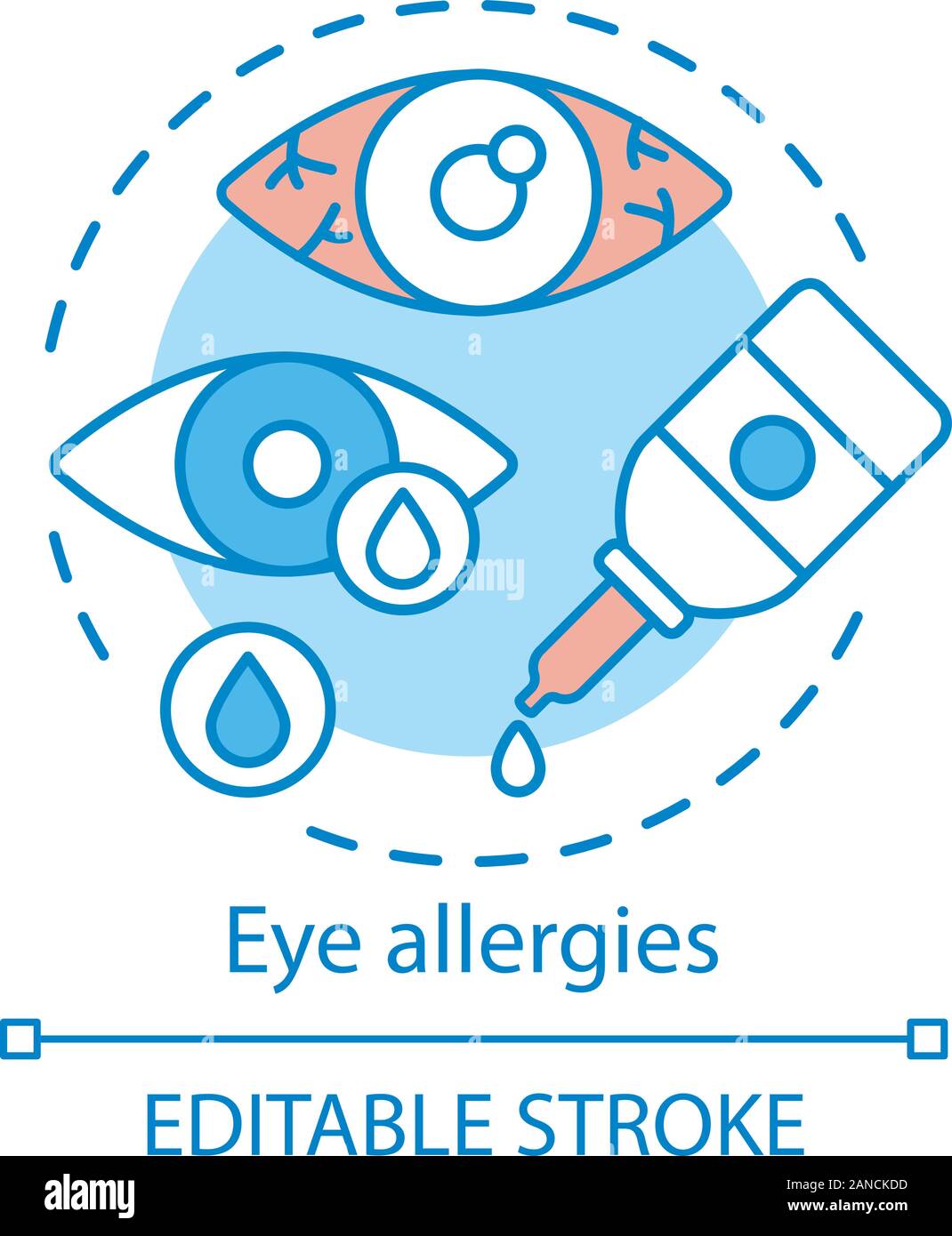 Eye allergies concept icon. Allergic conjunctivitis idea thin line illustration. Seasonal spring