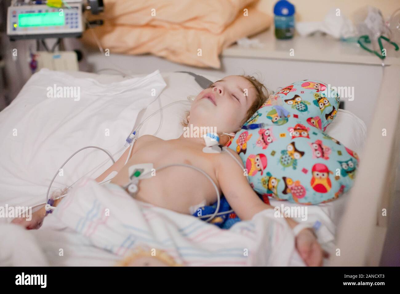 Toddler splay in hospital bed after surgery hooked to central line. Stock Photo