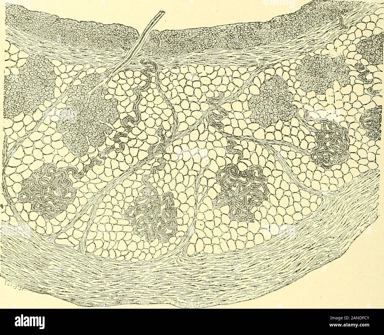 Treatise on gynaecology : medical and surgical . by Friedlander. Sudoriparous glands are also found.The hairs, whether free or imx3lanted, are long, tawny, agglutinatedtogether by sebaceous matter, and sometimes rolled into little balls.Sebum resembling the vernix caseosa partly fills the cavity, and oftenforms small, isolated masses; it is sometimes oily in consistency, andcontains many epithelial cells, cholesterin crystals, and fatty acids.Teeth and bones have been found in these cysts; the bones are in-serted in the wall, and more or less covered by the dermic layer; they VOL. II.- 98 CLIj Stock Photo