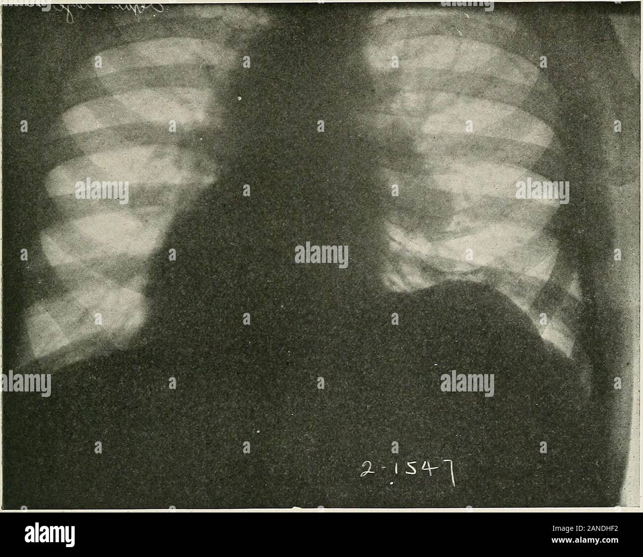 Street dieulafoy hires stock photography and images Alamy