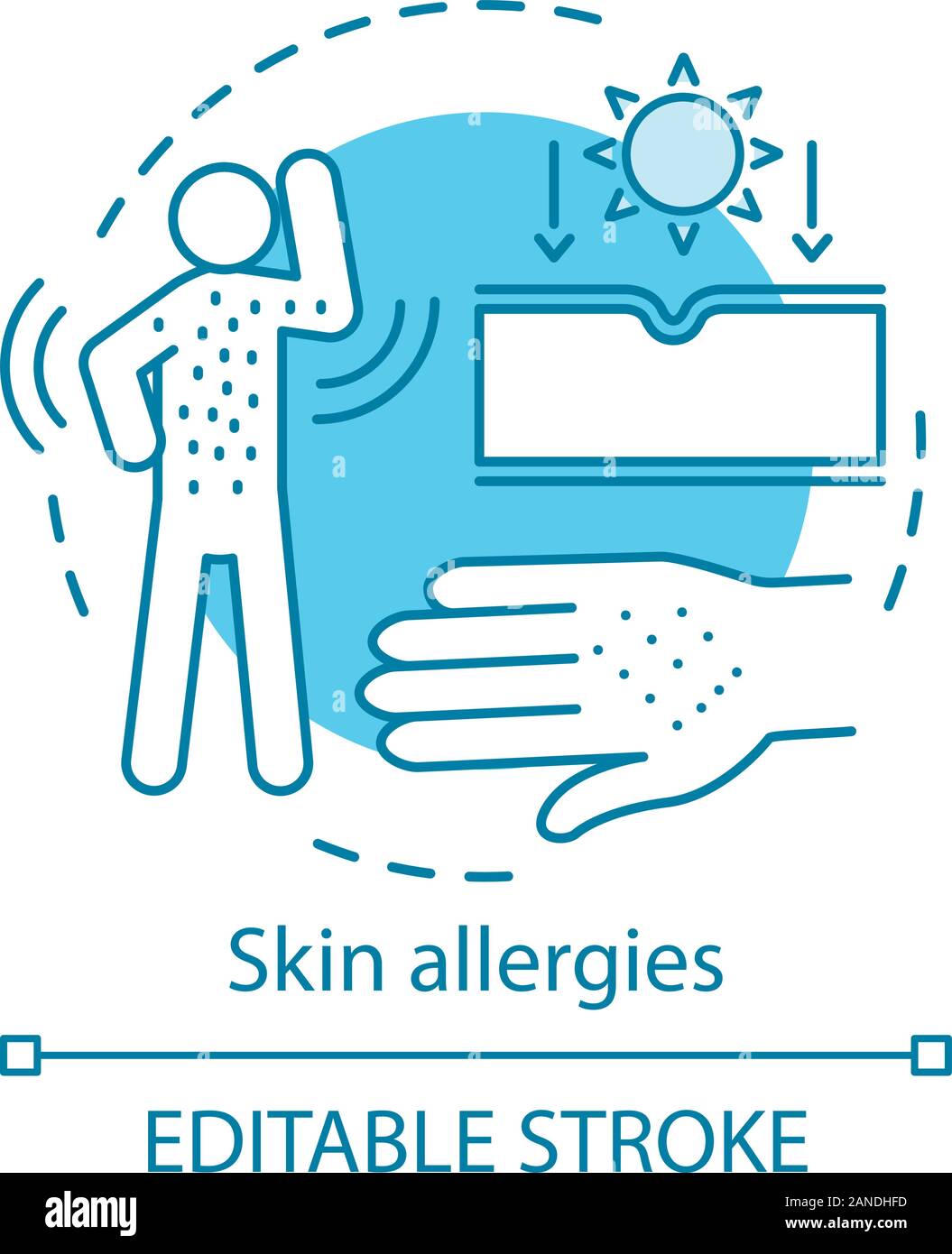 Allergies color icons set. Peanut, milk, dust, mold intolerance