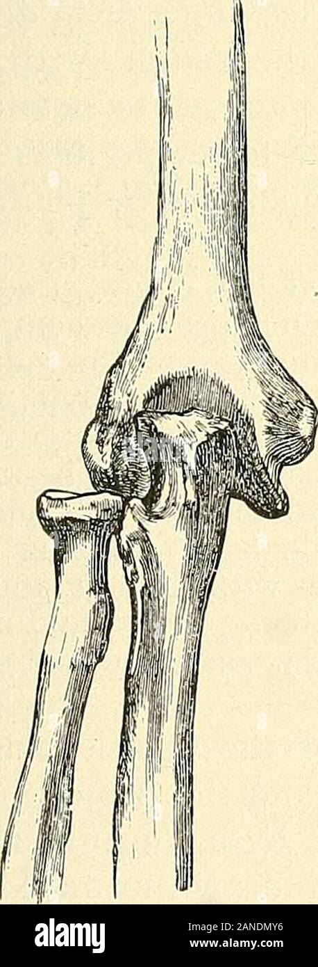 Annular ligament of radius hires stock photography and images Alamy