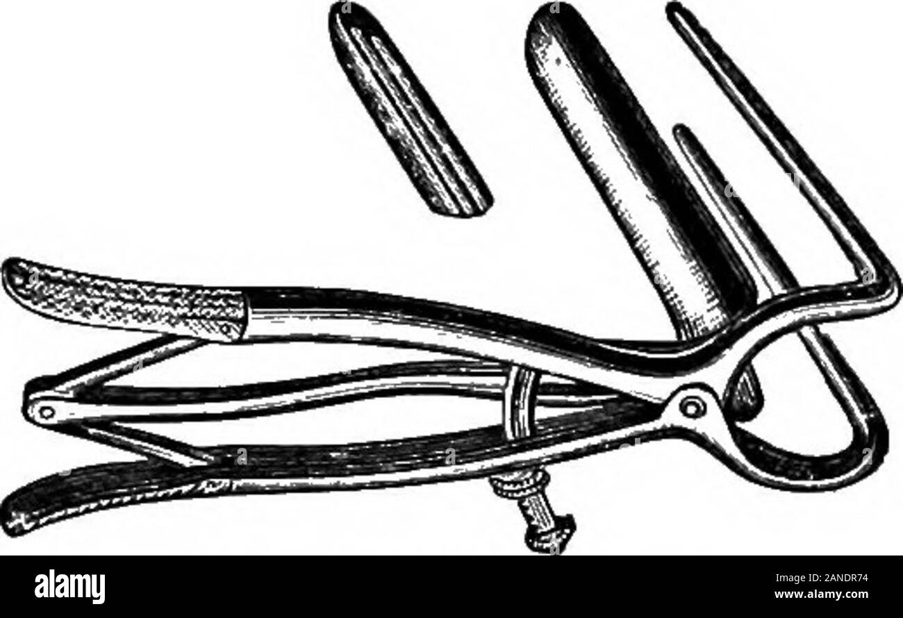 An illustrated encyclopædic medical dictionaryBeing a dictionary of the  technical terms used by writers on medicine and the collateral sciences, in  the Latin, English, French and German languages . MITTENDORFS EYE SPECULUM.