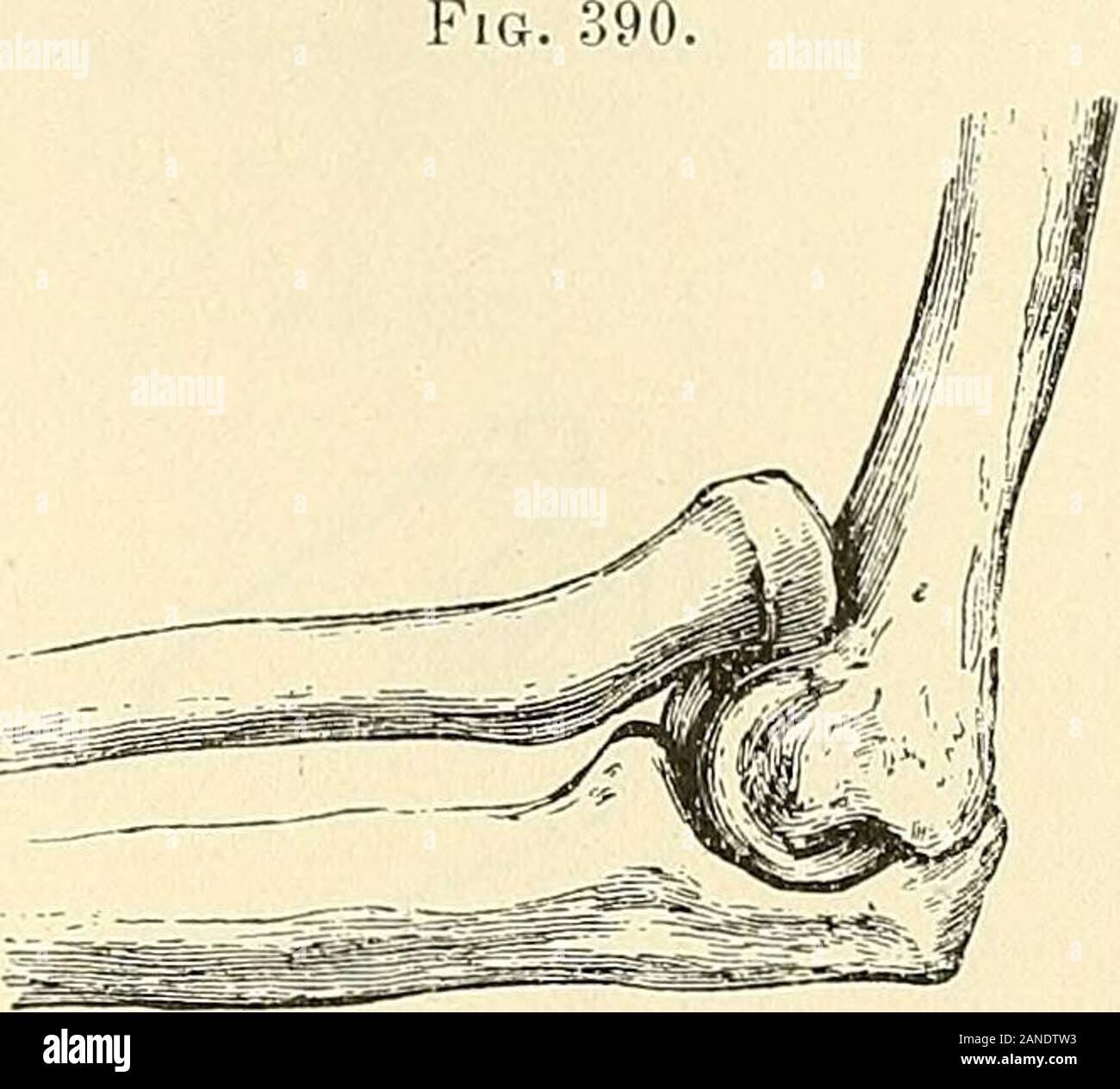 A practical treatise on fractures and dislocations . rearms, practised for the purpose of resuscitatingthe child. 1 Batchelder, New York Journ. Med., May, 1856, p. 333. 2 Sylvester, Araer. Journ. Med. Sci., vol. xxxi. p. 206, Jan. 1843. 3 Goyrand, Ibid., vol. xxxii. p. 228, July, 1843. 4 Krackowizer, New York Journ. Med., March, 1857, p. 262. 5 Leisrinck, Deuts. Zeitschrift fiir Chir., Dec. 12, 1873. DISLOCATIONS OF HEAD OF RADIUS FORWARD 617 Pathological Anatomy.—The head of the radius is carried forwardupon the humerus, and generally a little outward. In the case of LydiaMerton, already ment Stock Photo