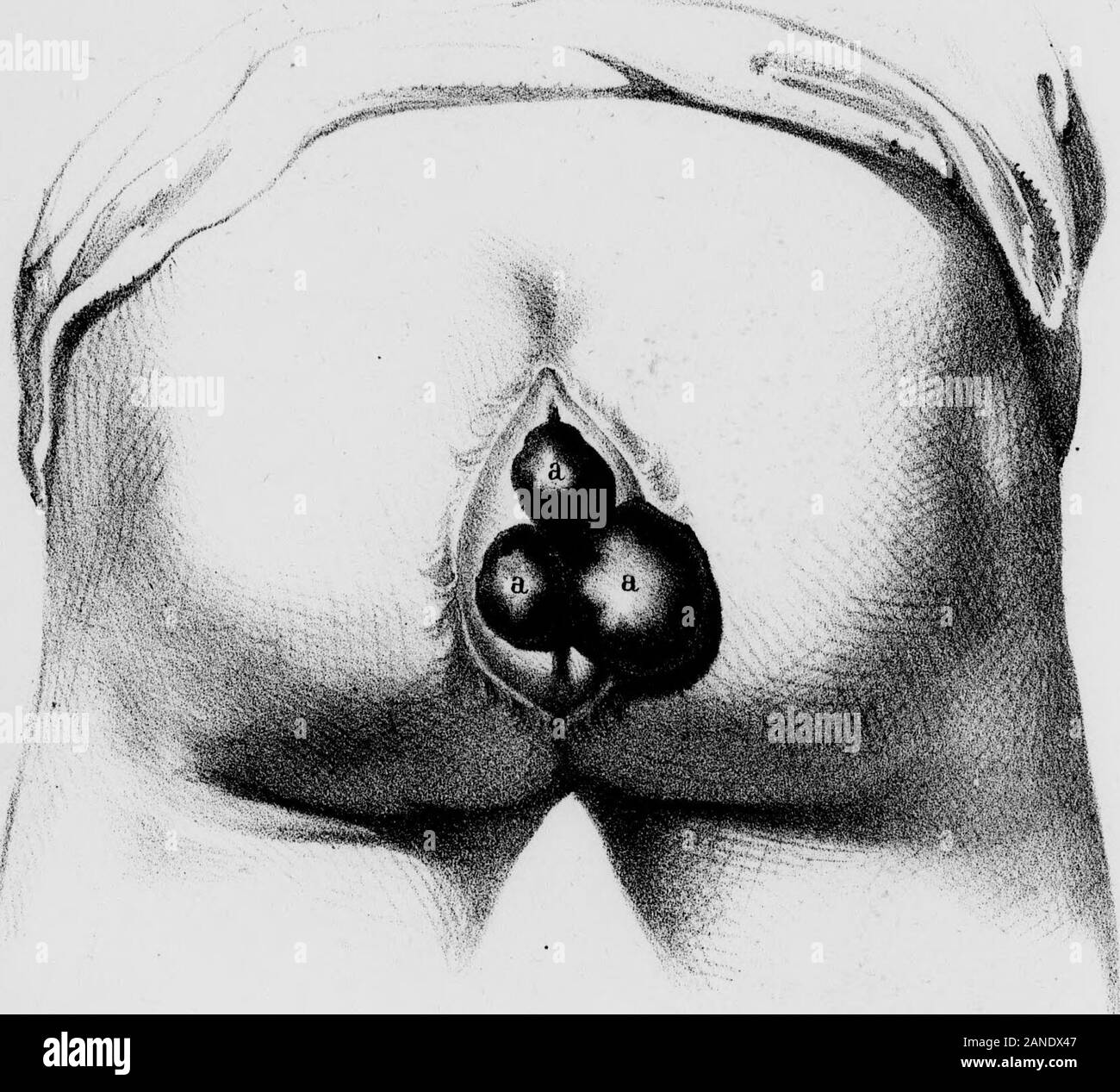 Keng kokrak uchlari bilan porno videolar Keng kalçalı qizlarning fotosuratlari