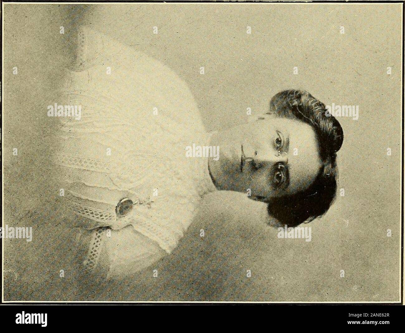 Tabes dorsalis hires stock photography and images Alamy