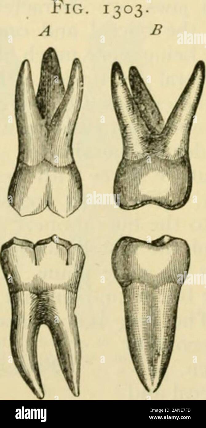 Human anatomy, including structure and development and practical considerations . The grinding surfaces are f(jur-sided ; those of the upper are somewhat dia-mond-shaped, the buccal anterior angle being rather in front ; those of the lower arenearly parallelograms, the long diameter being antero-posterior. Tyj)ical uppermolars have four cusps at the angles ; typical lower ones have an additional cusp atthe posterior border ; but in the upper jaw the first is the only one that can be calledtypical. In the upper molars the largest cusp is the anterior lingual, which is connectedby a ridge (the c Stock Photo