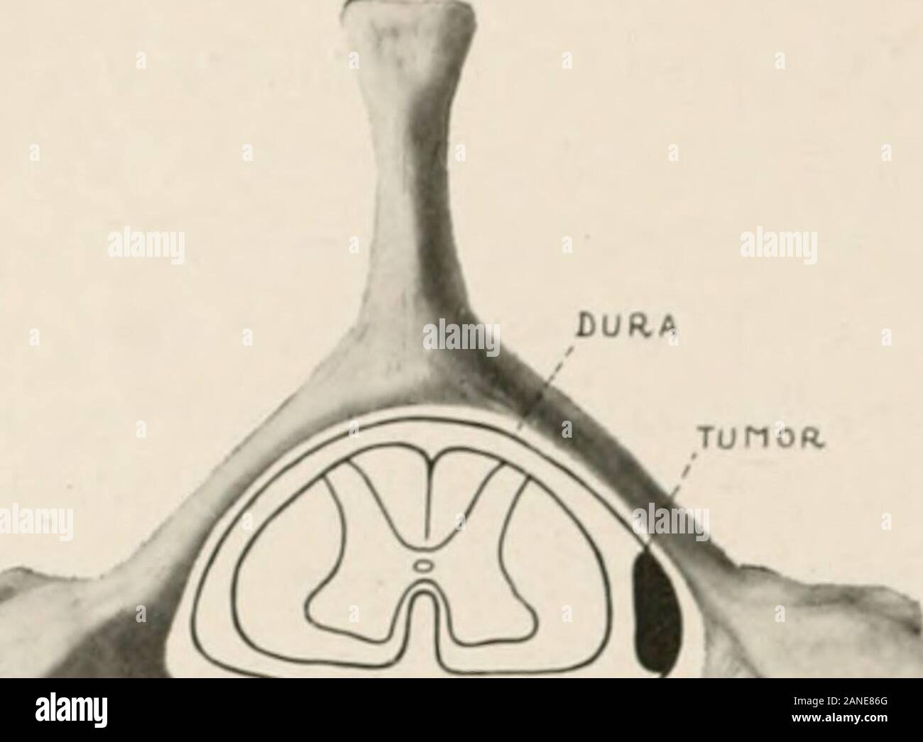Amaarchives Of Neurology Psychiatry Or On The Leftside Of The Cord A An Early Stage Of Its Growth To The Right In The Diagram B A Later Stage When The