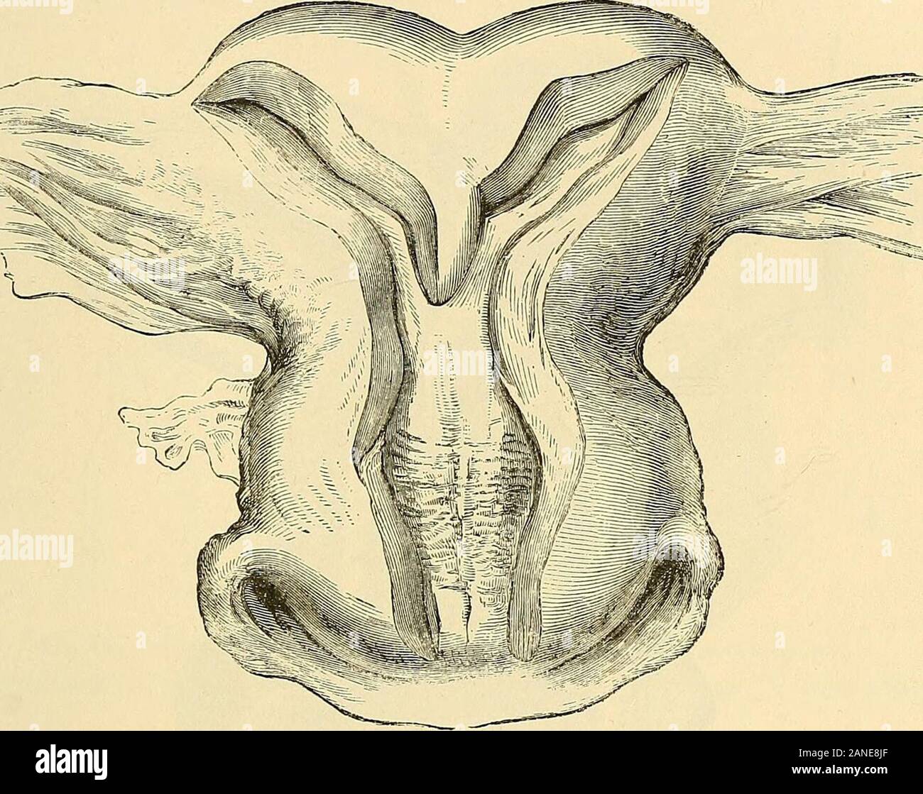 Vaging Grosseur Au Début Du Vaginas _ Masse Au Niveau Du Vagin – QGBR