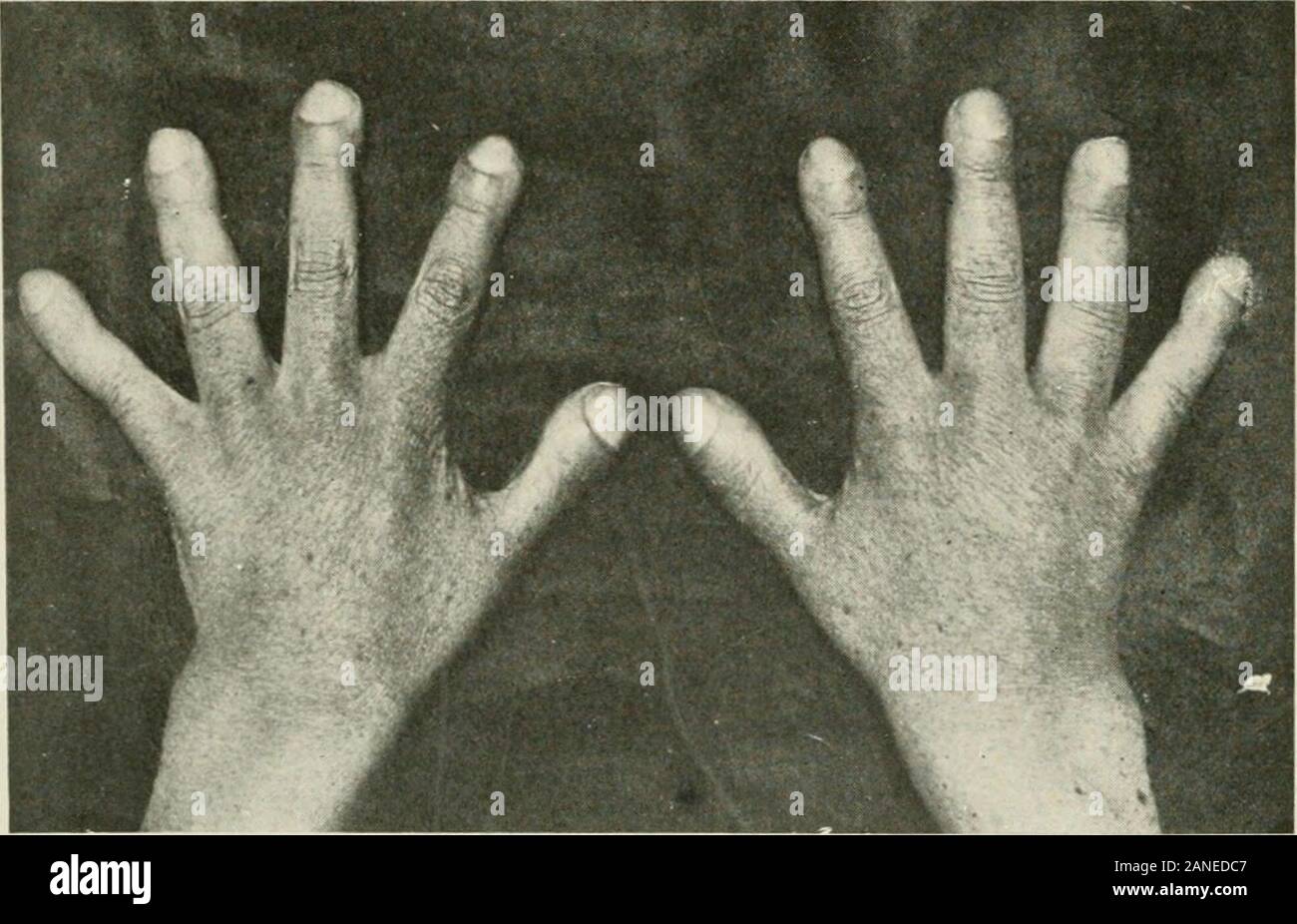 Diseases of the chest and the principles of physical diagnosis . Fig