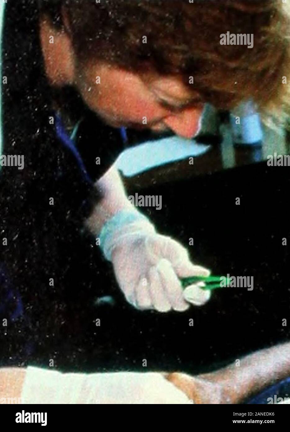 Ileal conduit formation hires stock photography and images Alamy