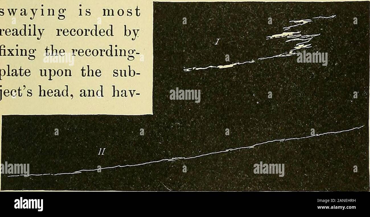 Involuntary hand movements hi-res stock photography and images - Alamy