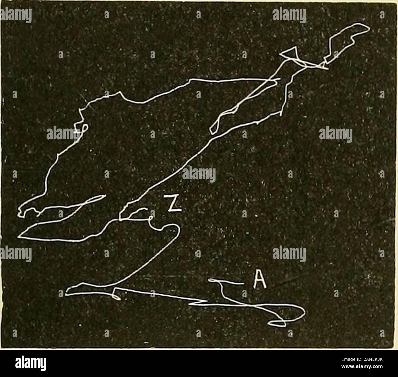 Involuntary hand movements hi-res stock photography and images - Alamy