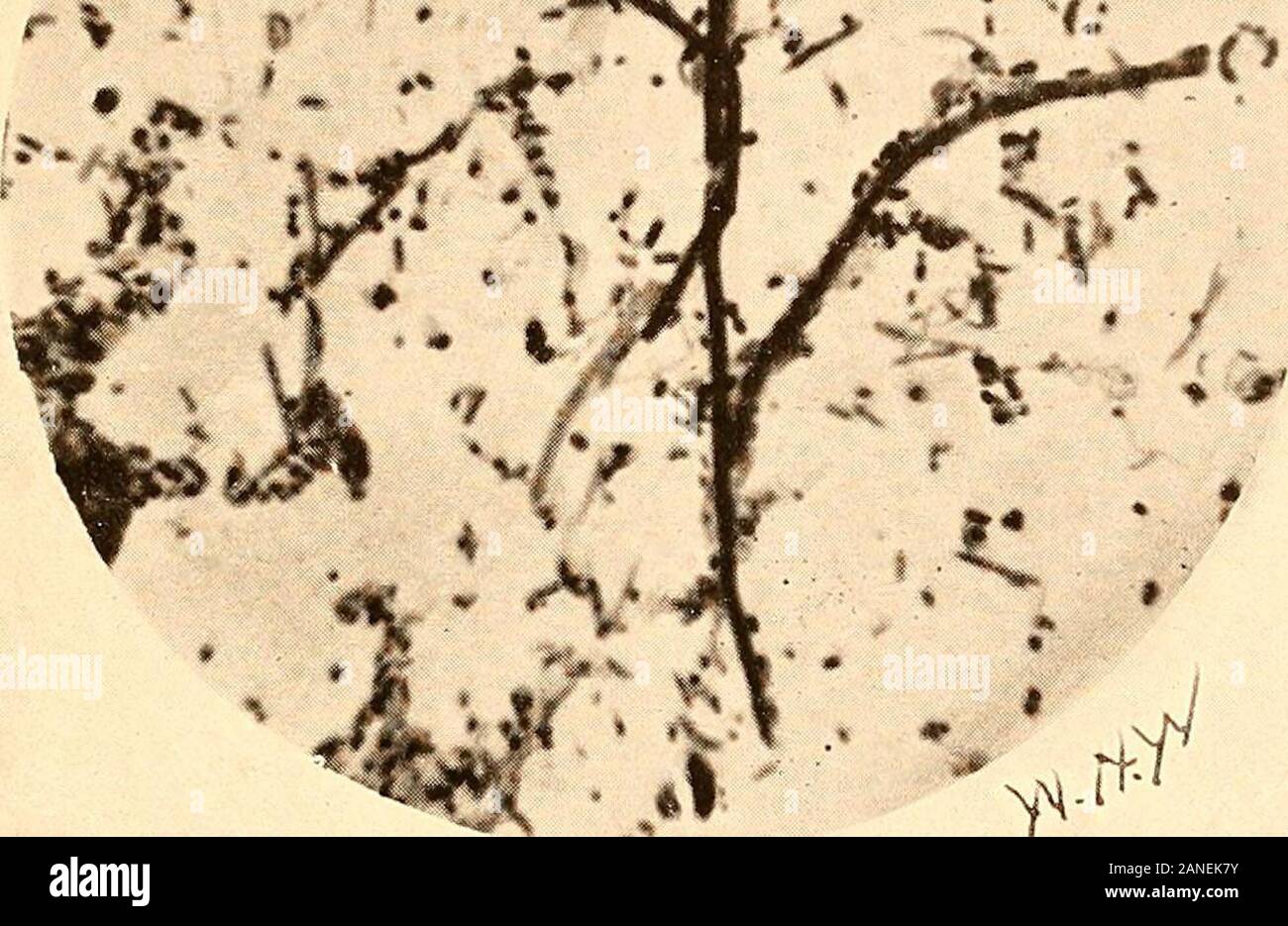 Principles And Practice Of Operative Dentistry Are So Joined As To Form A Letter S They Are Non Motile And Multi Ply By Fission And During This Process They Form Chains Of Cocci Principles And Practice Of Operative Dentistry Are So Joined As To Form A Letter S They Are Non Motile And Multi Ply By Fission And During This Process They Form Chains Of Cocci