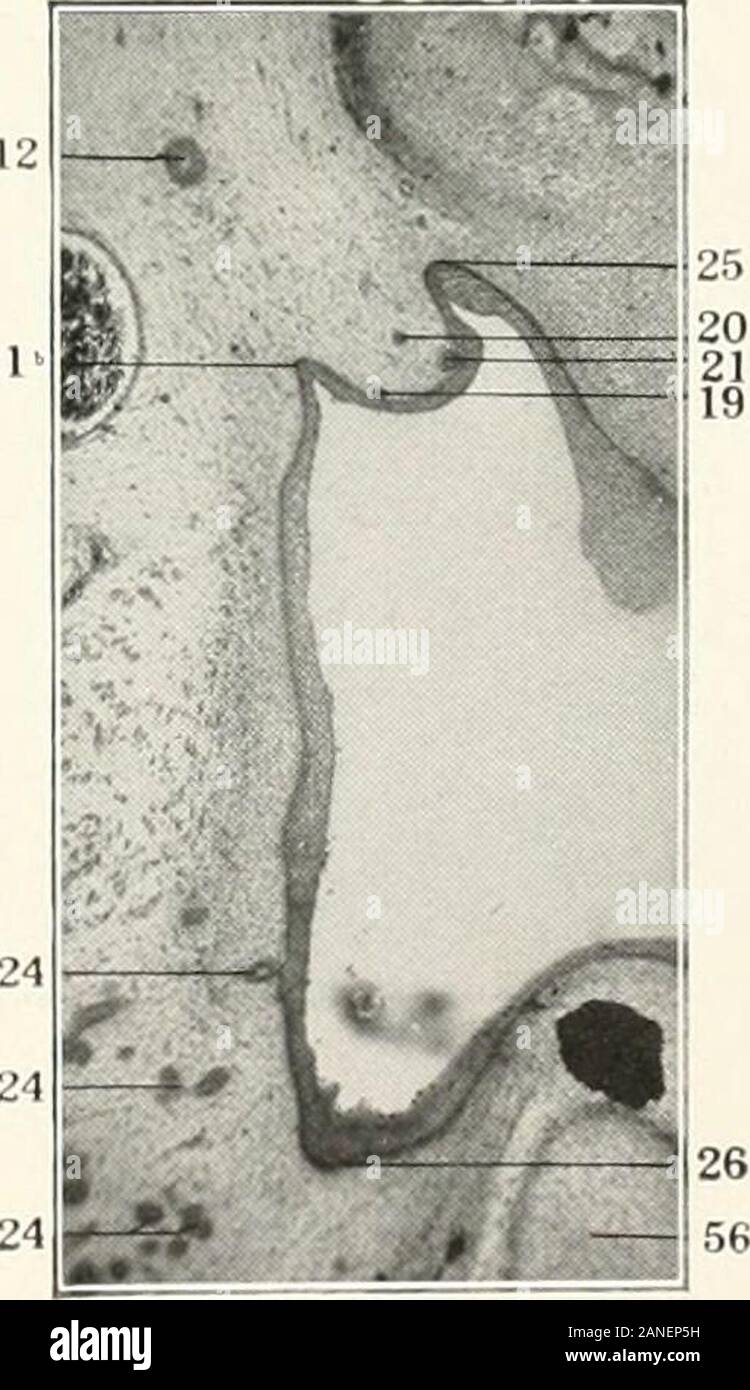 Contributions to the anatomy and development of the salivary glands in the mammalia . FIG.115. FIG. 116. Plate LXX Figs. 118-121. Sections of the alveolingual region of an 11 millimeter embr&gt;o.Columbia Collection, No. 213. Every third section. Thickness ofsections 13.3 /i. X 115, reduced to i. 2Q. Lingual sulcus. JO. Submaxillary anlage. 40. Lateral tongue swelling. 41. Tuberculum impar.4j. Palatolingual plane. 44. Alveolingual region. 45. Palalomandibular plane. 46. Maxillomandibular plane. 47. Hypoglossal nerve. 48. Lingual nerve. 4y. Submaxillary ganglion. 55. Meckels cartilage. 65. Inf Stock Photo