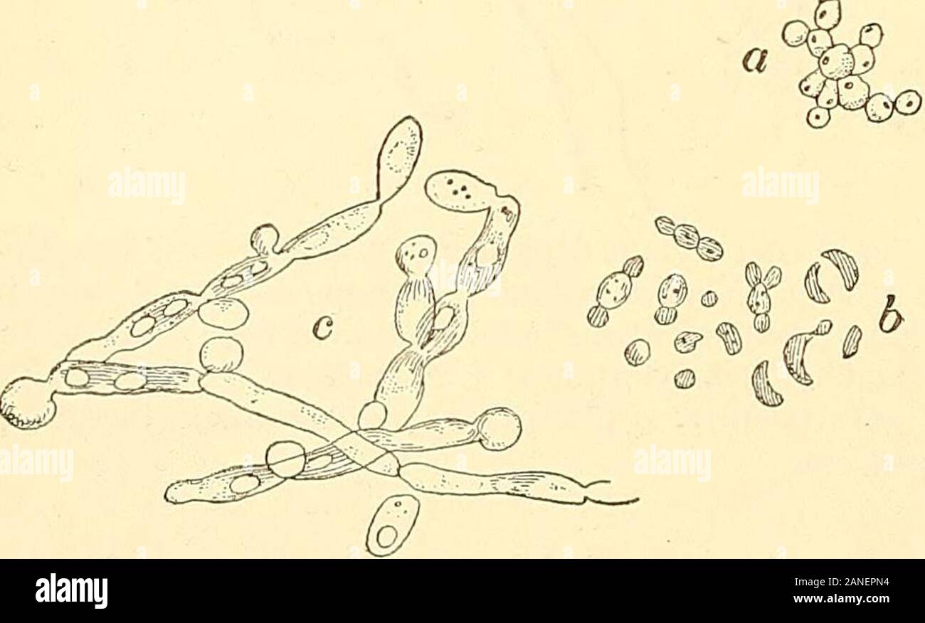 Principles and practice of operative dentistry . termed Aerobes, the other Anaerobes. The aerobic bacteria requireFw. 228. the oxygen of the atmosphere in order to maintain existence,and therefore live upon the sur-faces of substances. The yeast fungi are examplesof aerobic bacteria (Fig. 228). Fig. 229 shows one of the forms of yeast fungi—the torula. The anaerobic bacteria do not require oxygen to maintain existence, hence they live be- Various forms of yeast fungi, a, colonies of round „ „ cells (saccharomyces conglomerate?); 6, single Cells of neatll tne SUITaceS 01 liquids different forms Stock Photo