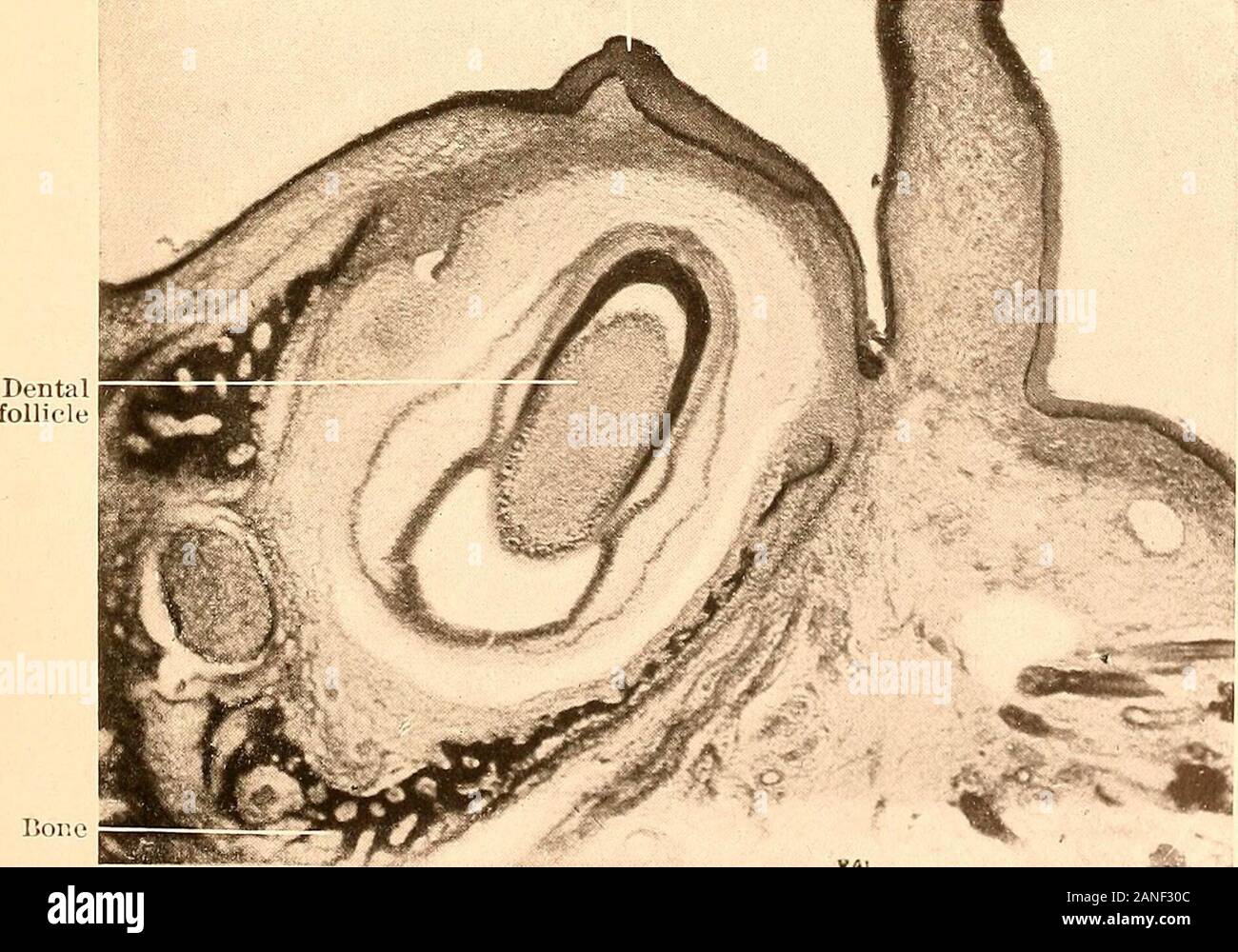 Principles and practice of operative dentistry . Mucous membrane