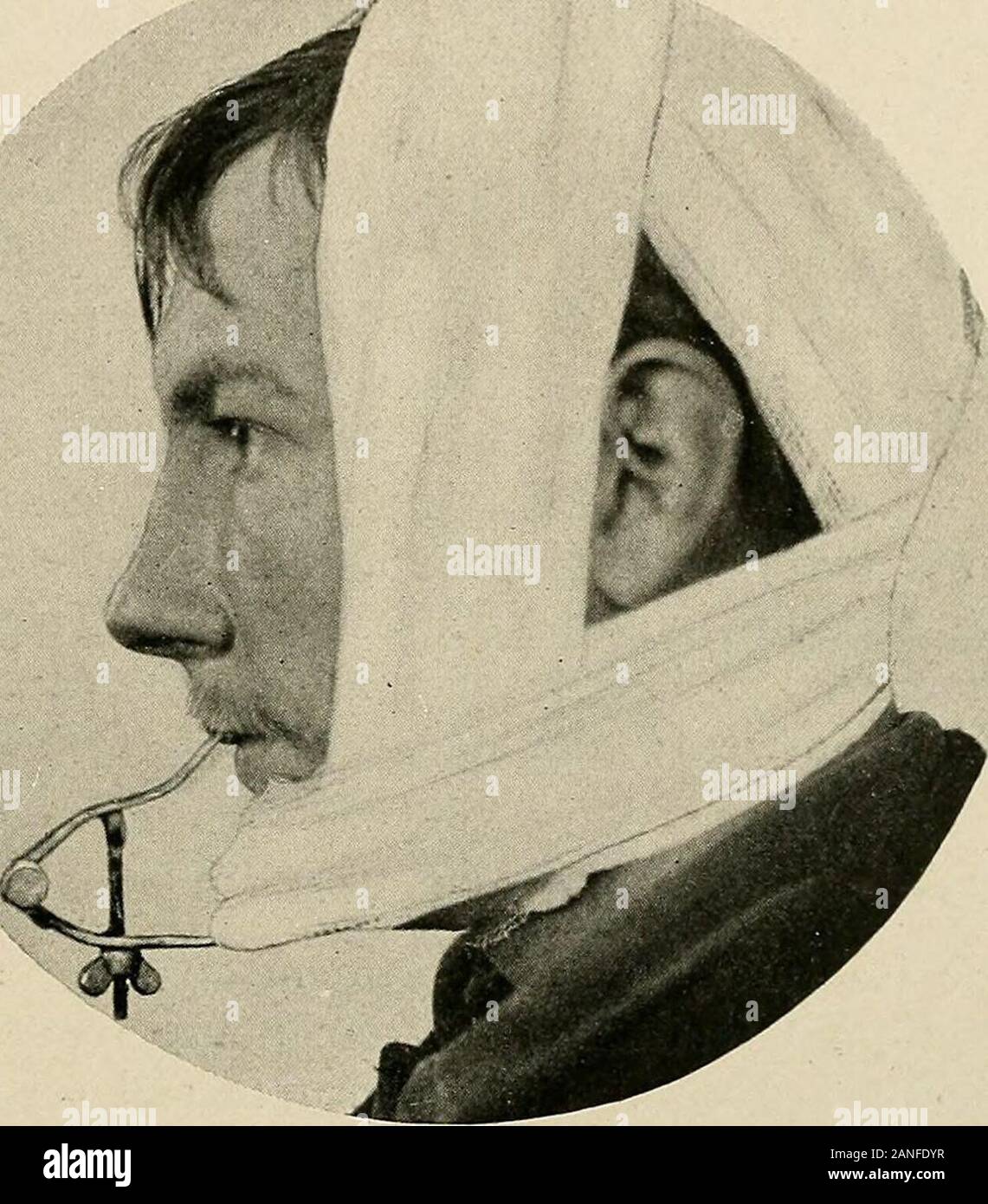 Four tailed bandage hires stock photography and images Alamy