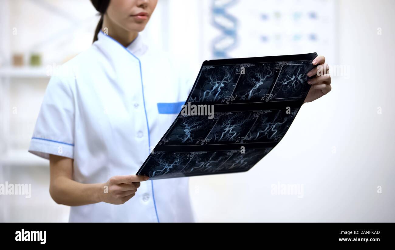 Attentive female neurosurgeon looking at brain vessels x-ray, analyzing results Stock Photo