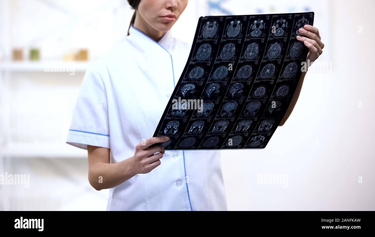 Experienced neurosurgeon looking at brain x-ray, upset with examination result Stock Photo