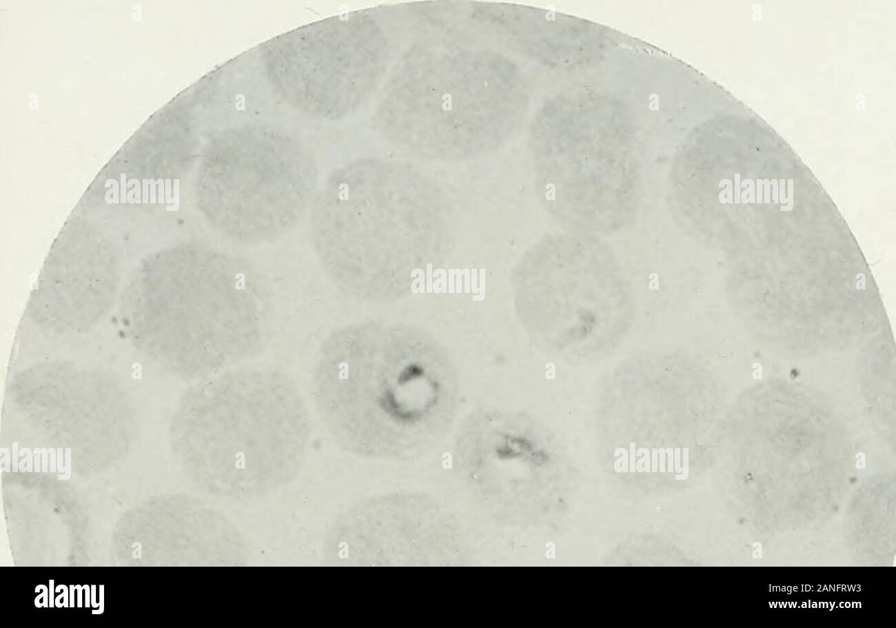 Annals of tropical medicine and parasitology . ^;-; &lt;^,.--,^ f^^: i. 4k ^ 4 i %-, vjg^. 3 •4»^ ?-» V-- ? i V • -? V: t»* •-..^?- cAruixxls Trop.Med. d Para^iJbol., Vol. VII. PLXxm. O O 2. 0 «* 4. •i 6. •AU & m -A 9. 10. n. ?JTr« 12. 13. 14. 15. 16. 17. ^ 18. 19. 20. ZL. 22. 23. »•*•• - *?• ?• ???;.v.&gt; ??.,/? 26. 27. J. G.Tiiamsan ScD.Tiiamsaii.del. 28. 29. 30.Hulh lili.. et ifnp CULTURAL FORMS OF MALARIAL PARASITES Amah Trap. Med. & Parasilol, Vol Ill. ^ PLATE XXXF Stock Photo