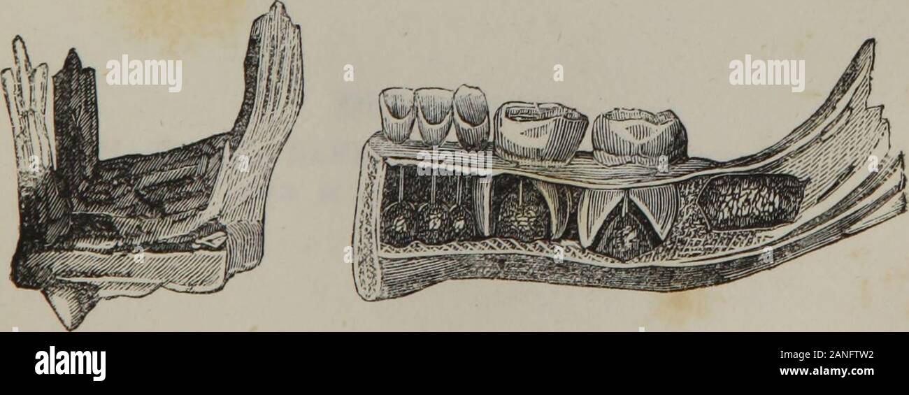 John hunter hospital hires stock photography and images Alamy