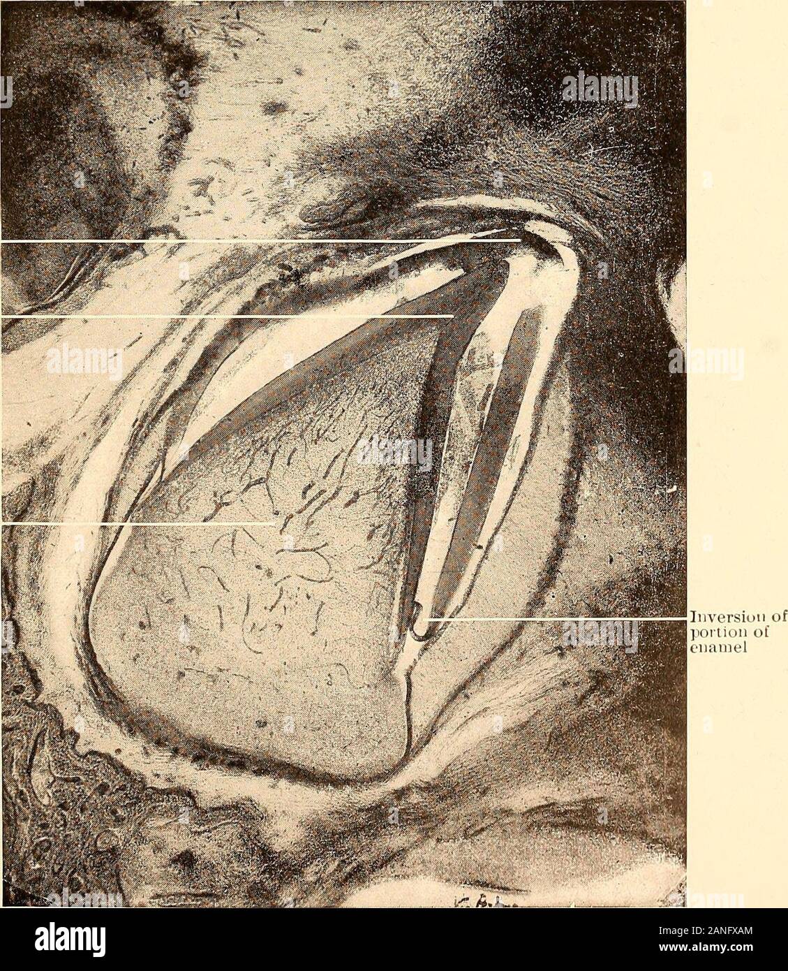 Principles And Practice Of Operative Dentistry Blood Vesselsand Nerves Blood Vesselsand Nerves Fig 167 Section Of Human Lower Jaw Showing Blood Vessels And Nerves At Base Of The Tooth Follicle And Thebeginning Of The Formation Of