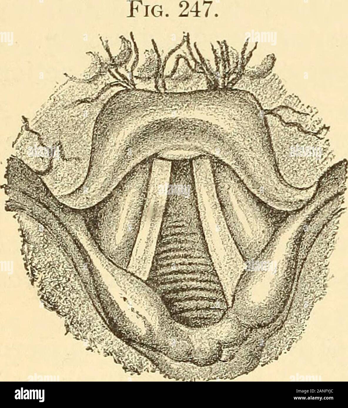A text-book on diseases of the ear, nose and throat . ARYNX. These may be of the simple exudative variety, coming on alone or asa complication of many systemic states and general fevers. In addition,there are the acute conditions due to specific causes, such as syphilis andtubercle, and those attended by membranous formation, such as diph-theria, true and false. Acute Cataerhal Laryngitis.—This is an exudative inflamma-tion of the mucous lining of the larynx, the peculiarities of which in thissituation are due to anatomical conditions. Etiology.—Modern views incline to the belief that acute ca Stock Photo