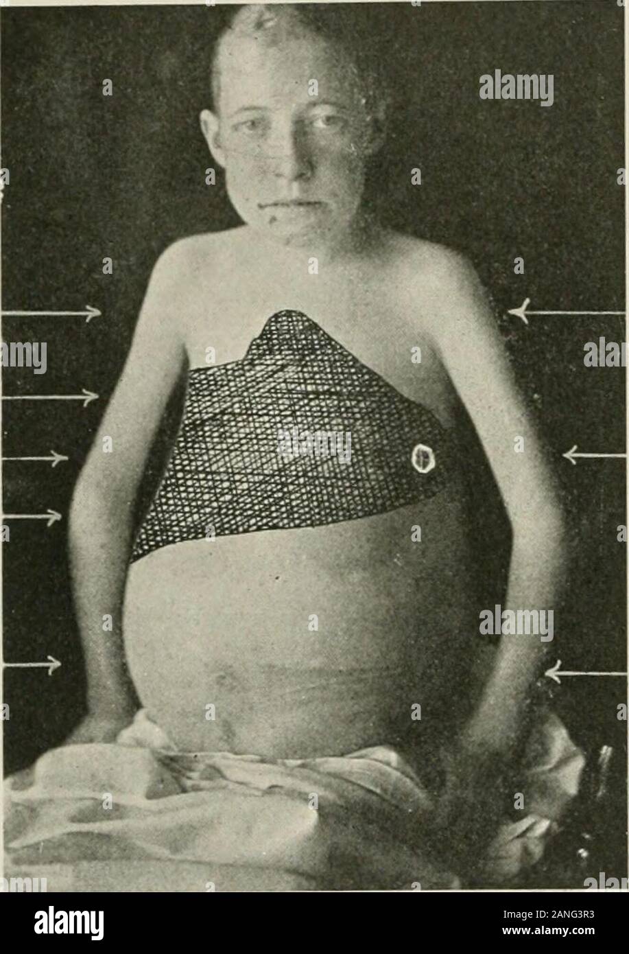 Diseases of the chest and the principles of physical diagnosis . ATION