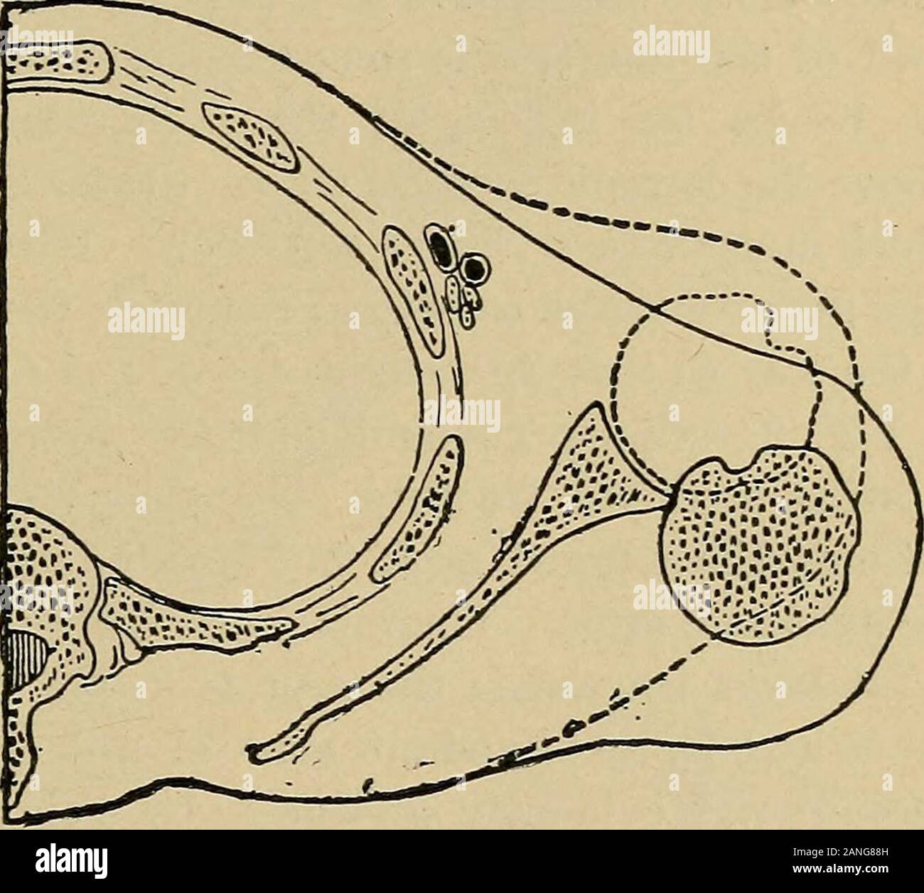Glenoid fossa hires stock photography and images Alamy