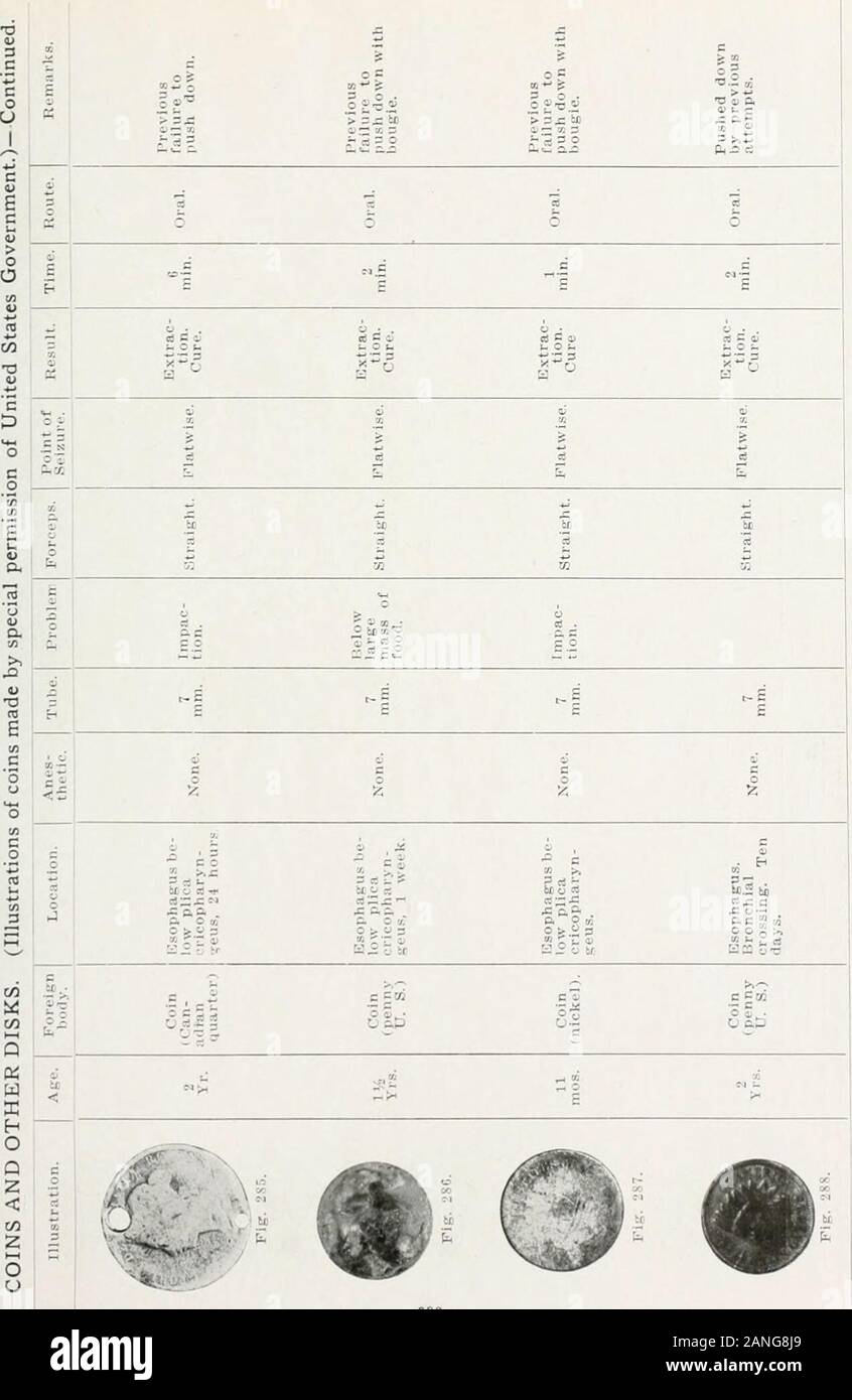 Peroral Endoscopy And Laryngeal Surgery 3 Ic A O Il Gt X D A A Sa Gt S A J Br J I 2 T I To C5 3 2 O Gt C 3