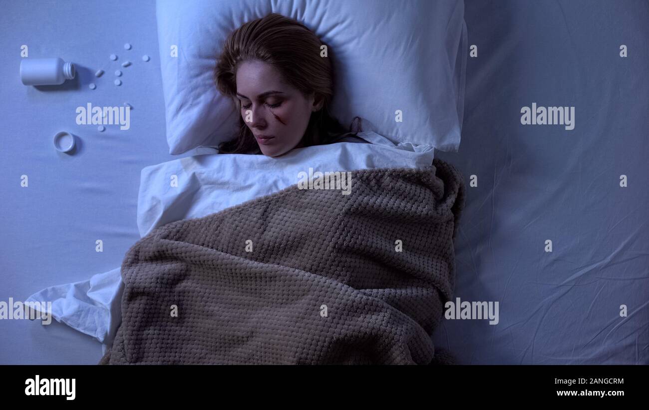 Young injured female in bed, medication overdose, suicide attempt, top-view Stock Photo