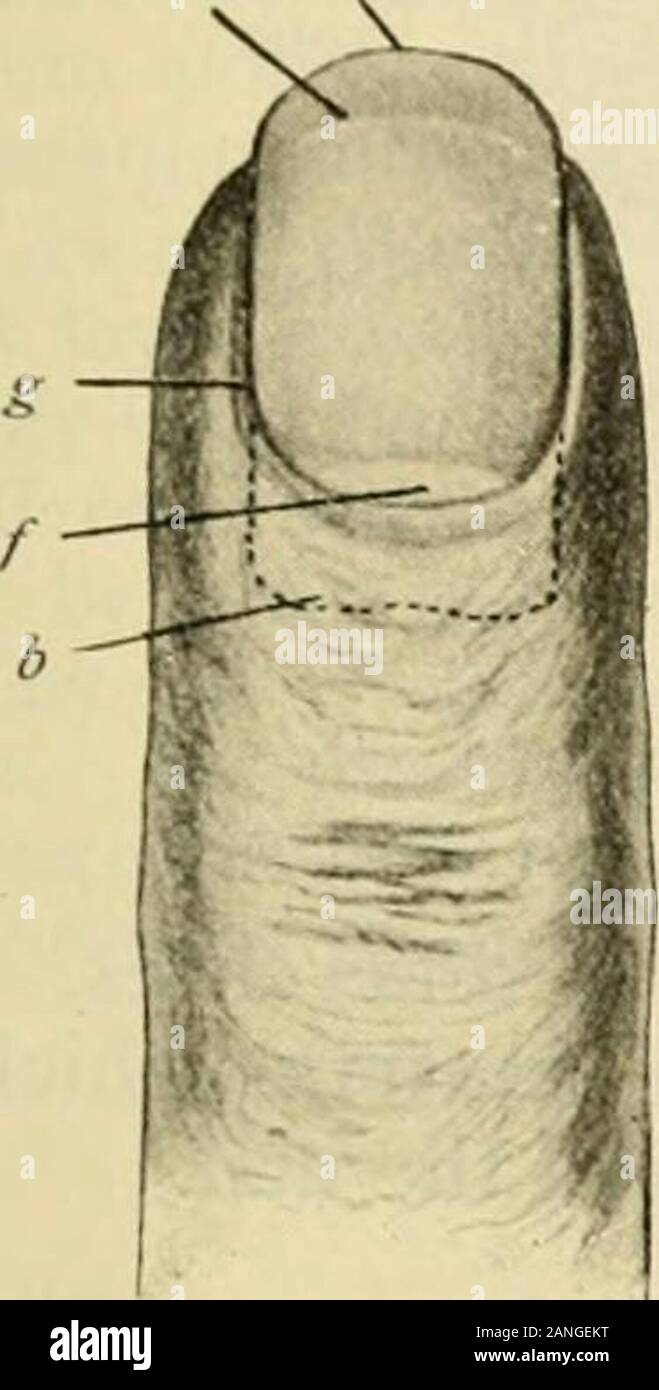 Human anatomy, including structure and development and practical considerations . nail-plate, both the boily and the root, constitutes the nail-bed(solum un.uuis), the cutaneous fold overlying- the root being the nail-wall ( valiuuiunjiuis). The sides of the tjuadrilateral nail-plate are straight and parallel and at theirdistal entls connected by the convex free margin ( maryo lihcr; thai projects for avariable distance beyond the skin. The proximal buried border (marijo occultusj isstraight or slightly concave, more rarely somewhat convex, and often beset withminute serrations (Brunn). Both s Stock Photo