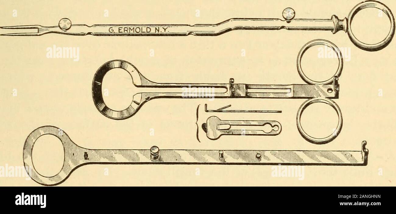 Tonsil guillotine hi-res stock photography and images - Alamy