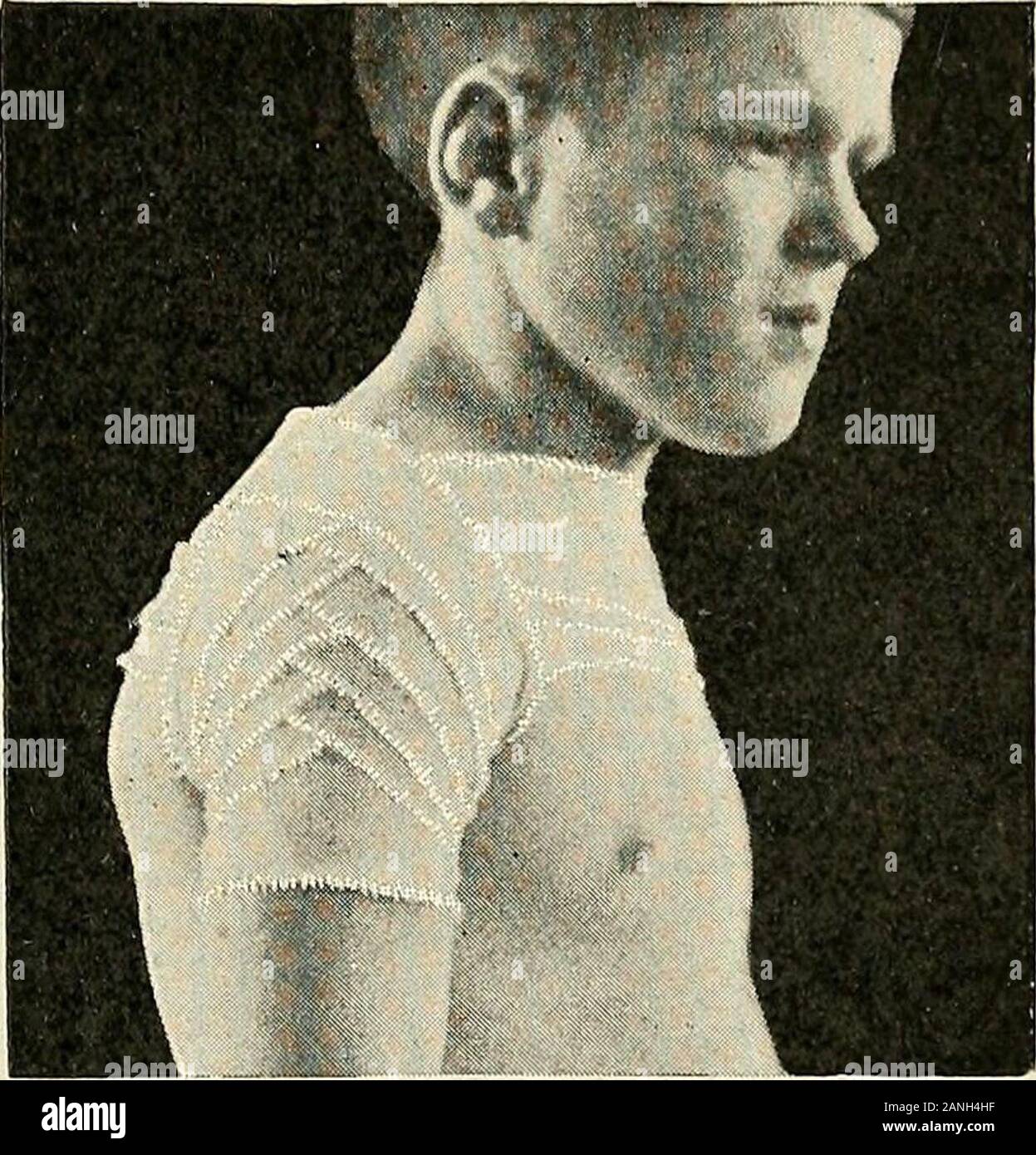 Circular band aid hires stock photography and images Alamy