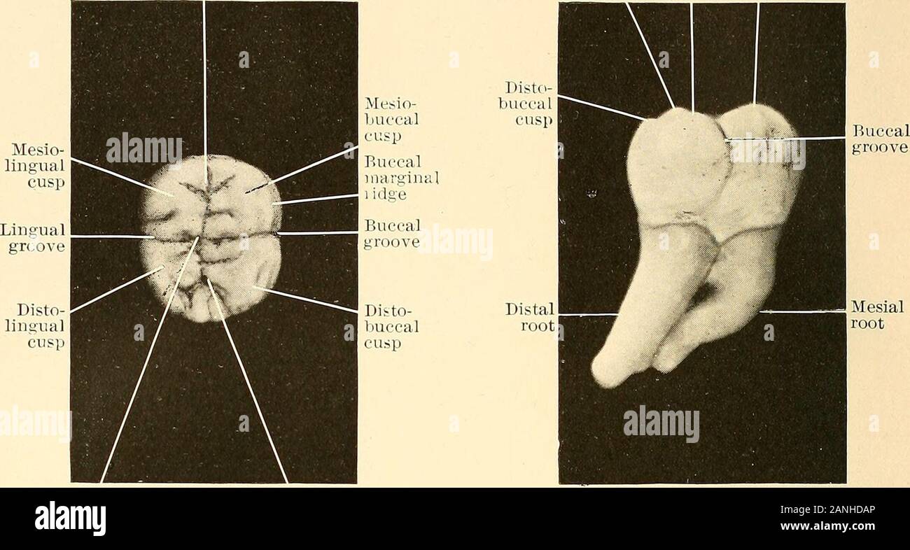 Principles and practice of operative dentistry . Fig. 75.—Inferior