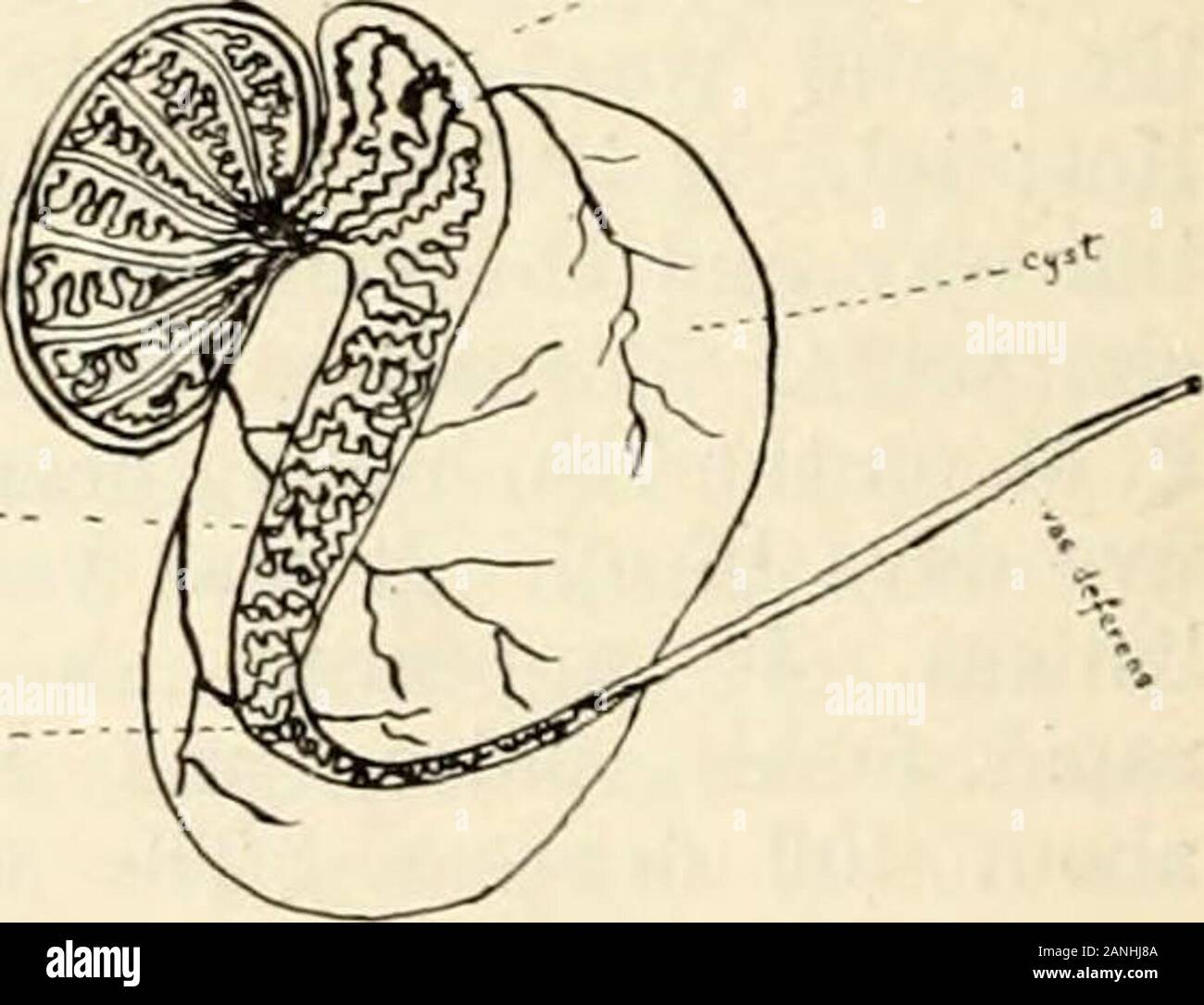 Hydatid of hires stock photography and images Alamy