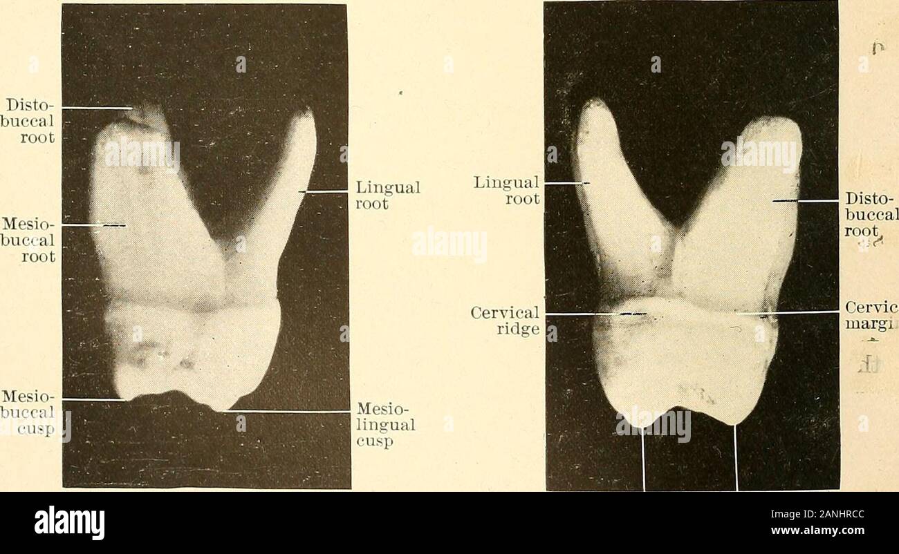 Principles and practice of operative dentistry . Buccal grooveSuperior