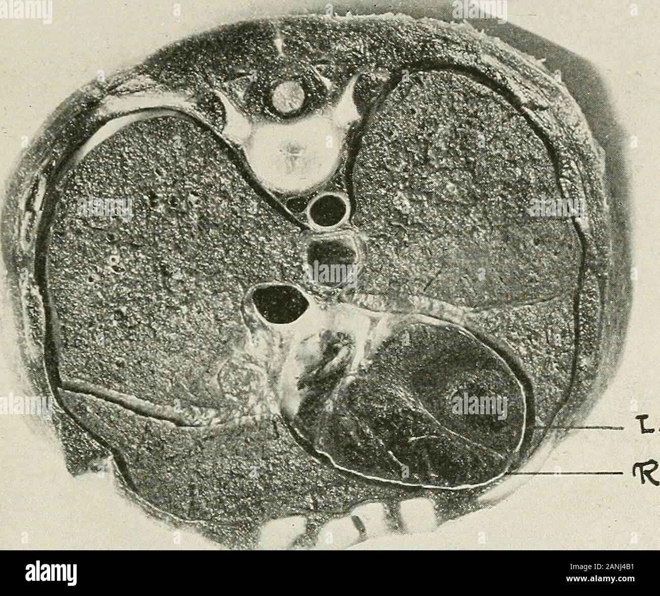 Diseases of the chest and the principles of physical diagnosis