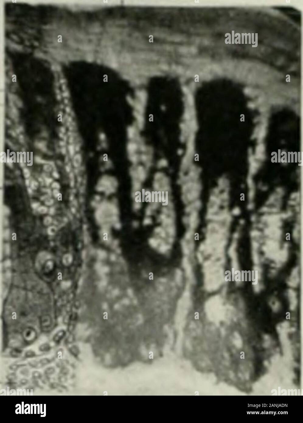 The anatomical record . ate cells differentiatinginto feather l&gt;arl)ules are shown with their cytoplasm packed with melaningranules received from mclanophorcs. .l the left, histological details have beenndihil with a pen. a camera lucitla being employed. (&gt;c. 10; obj. 1.9 mm. oilinuner.sion i Hausch A- Lombi. The picture was much reduced in publication.One barb-vane ridgi appears cotnplctcly, another at the left is almost all in thepicture, and a large portion of a third at the right is included. germ sections, according to Mrs. Knowlton. In all cases thepigmented inner .sheath cells we Stock Photo