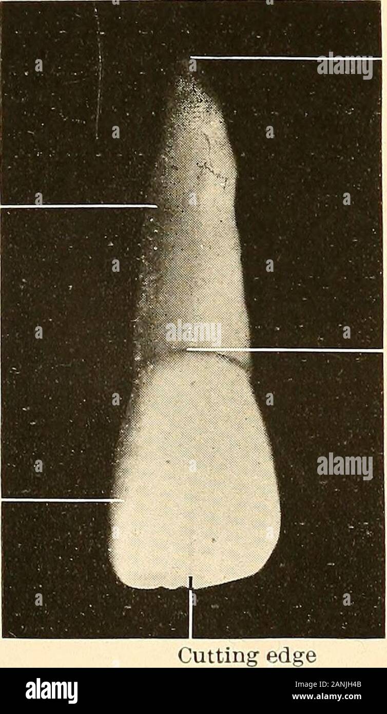 Principles and practice of operative dentistry . Fig. 5.—Occlusion of