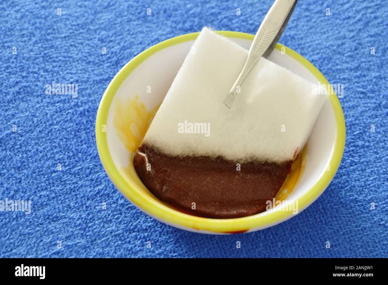 cotton wool with tweezers picking in iodine solutions on cup Stock