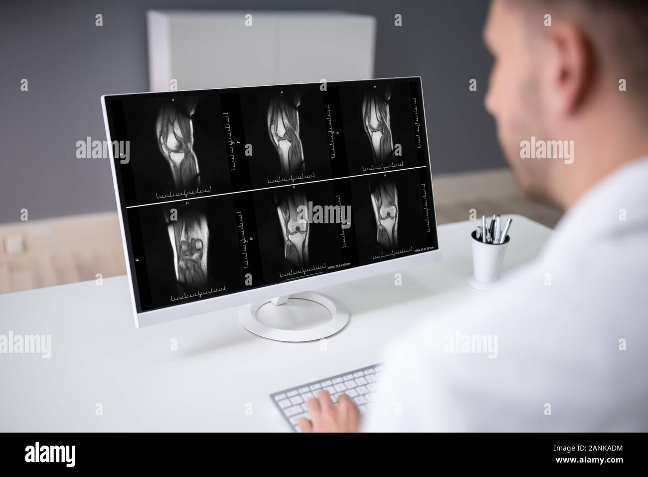 Mature Male Doctor Examining Knee X-ray In Clinic Stock Photo