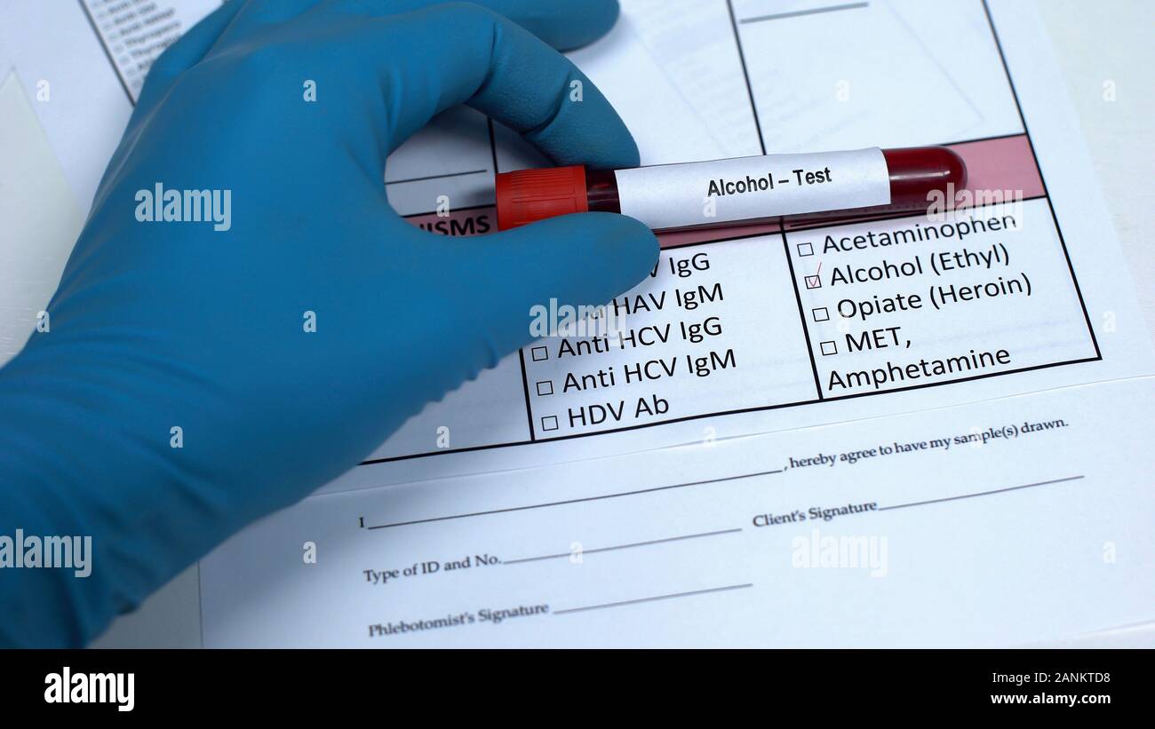 Alcohol test, doctor showing blood sample in tube, lab research, health checkup Stock Photo Alamy