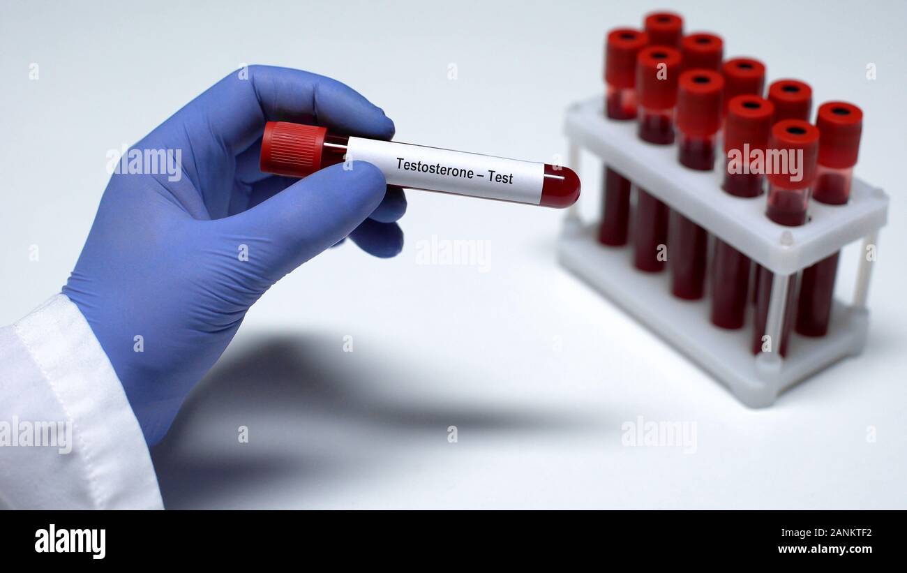 Testosterone, doctor showing blood sample in tube, lab research, health